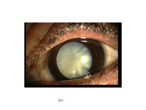 エビスクリニック眼科のブログ – 日ごろ気になる目の症状・診療